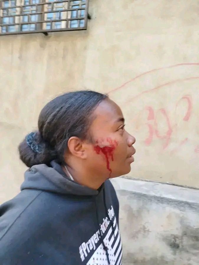 Jeune femme malgache matraquée au visage avec une plaie ouverte