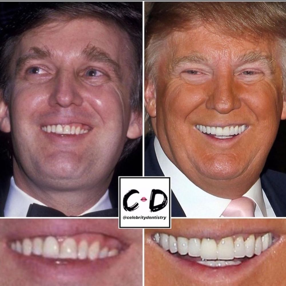 tRump's teeth comparison 1980s to present 