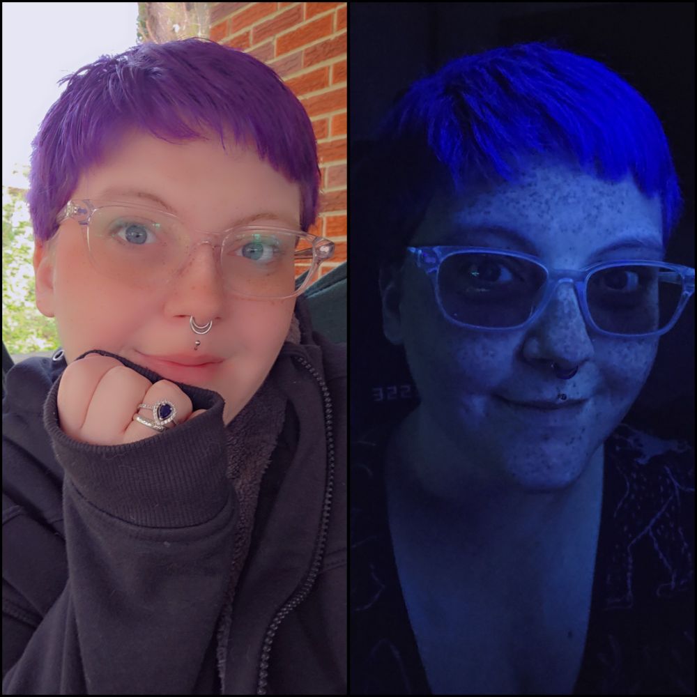 A collage on 2 images.
Photo on the left: a person with a short sassy pixie cut dyed bright neon purple is resting their face on their hand, showing a wedding ring set in a teardrop sapphire. They are wearing clear acrylic glasses and have septum and Medusa piercings, blue eyes, and freckles. 
Photo on the right:
That same person is under a blacklight, all of their freckles showing up quite dark in contrast to their skin. Their purple hair is glowing vibrantly in a more blue shade under the blacklight. 