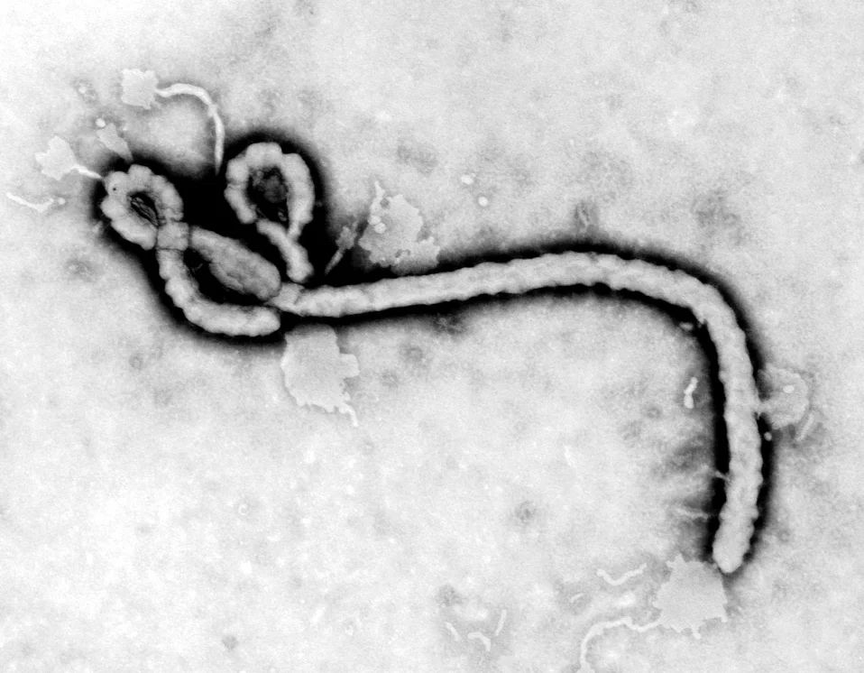 An Ebola virus, or possibly the Threads logo