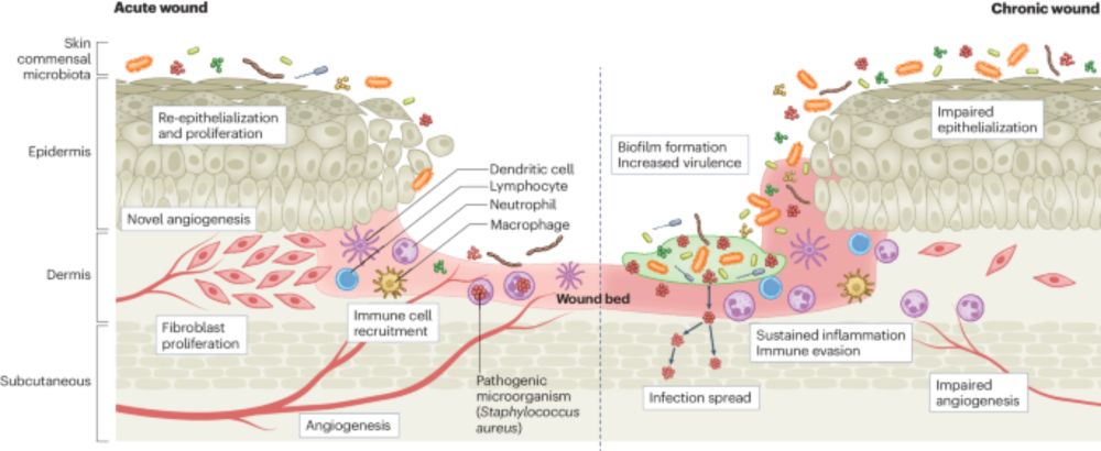 The wound microbiota: microbial mechanisms of impaired wound healing and infection - Nature Reviews Microbiology