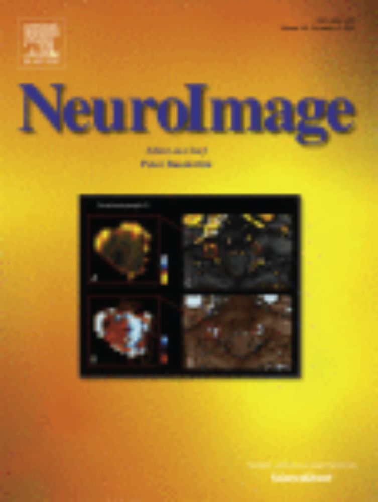 Evaluation of multi-echo ICA denoising for task based fMRI studies: Block designs, rapid event-related designs, and cardiac-gated fMRI