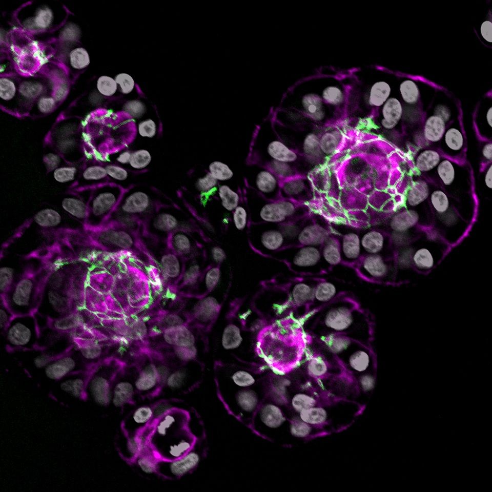 Three-dimensional confocal image of a swine trophoblast organoid immunostained for ZO-1 (green) and actin (purple), with nuclei counterstained using DAPI (grey). ZO-1 highlights tight junctions at the apical borders in the center of the organoids, while actin outlines cellular architecture, revealing organized epithelial polarity within the organoid structure. Image credit: Cole McCutcheon, Duke University.