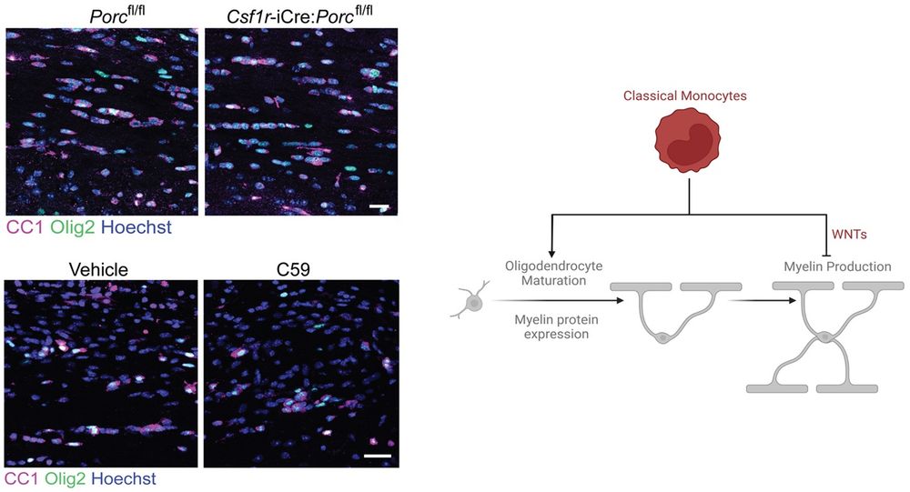 Top left: Representative immunofluorescent labeling of oligodendrocyte lineage cells (Olig2+, green) which are mature (CC1+, magenta) in Csf1r-iCre;Porcfl/fl compared to Porcfl/fl control mice at 14 dpl, counterstained with Hoechst. Scale bar, 20 μm. Bottom left: Representative immunofluorescent labeling of oligodendrocyte lineage cells (Olig2+, green) which are mature (CC1+, magenta) in Vehicle-treated and C59-treated monocyte transplanted mice at 10 dpl, counterstained with Hoechst. Scale bar, 20 μm. Right: Graphical abstract of results: Classical monocytes support oligodendrocyte differentiation and myelin protein expression, yet impede myelin production during remyelination in a Wnt-dependent manner. 
