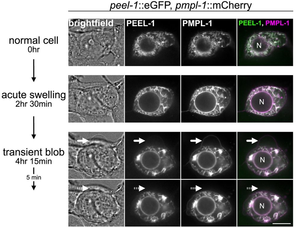 Selected frames of a live-cell imaging time-course experiment. A single cell is shown, co-expressing PEEL-1::eGFP and PMPL-1::mCherry. The nucleus is labeled (“N”). t = 0 is 16 hrs after transfection. Acute swelling can be seen (t = 2 hr 30 min), followed by a transient blob or protrusion (arrow) jetted out by the cell (t = 4 hr 15 min) and later reabsorbed (dotted arrow) (t = 4 hr 20 min). Scale bar = 10 µm. 