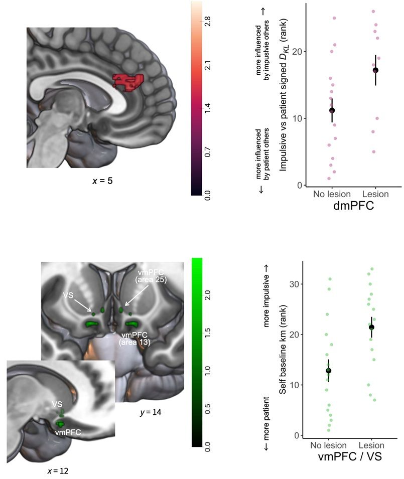 Top: Damage to dmPFC (area 9) enhances susceptibility to impulsive social influence. Left: Permutation-based, whole-brain, nonparametric voxel-based lesion-symptom mapping (VLSM) showed that damage to dorsomedial prefrontal cortex (dmPFC, area 9) was associated with heightened susceptibility to impulsive relative to patient social influence. Right: Plotting the ranked contrasts between susceptibilities to impulsive and patient social influence, separately for participants with damage or no damage in the areas identified by the VLSM analysis. N = 26 for this analysis where data from patient and impulsive was present. Bottom: Damage to vmPFC and ventral striatum increases temporal impulsivity. Left: Permutation-based, whole-brain, nonparametric voxel-based lesion-symptom mapping (VLSM) showed that the areas 13 and 25 in the vmPFC as well as ventral striatum where damage was correlated with increased temporal impulsivity. Right: Plotting the ranked self baseline discounting preferences, separately for participants with damage or no damage in the areas identified by the VLSM analysis (N = 33).