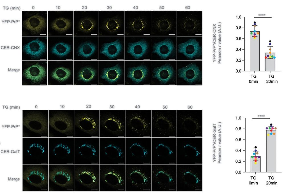 During RESET, misfolded GPI-APs traffic from the ER to the Golgi. Top left : Time-lapse imaging sequence collected immediately after thapsigargin (TG) treatment of a typical YFP-PrP * NRK cell that was co-expressing ER-marker, Cerulean-calnexin (CER-CNX). Scale bar represents 10 µm. Top right: Plot of the average Pearson’s r values between YFP-PrP * and CER-CNX for 9 individual cells across the 0 and 20 min time points of time-lapses collected after addition of TG. Bottom left: Time-lapse imaging sequence collected immediately after TG-treatment of a typical YFP-PrP * NRK cell that was co-expressing the Golgi marker, CER-GalT. Scale bar represents 10 µm. Bottom right: Plot of the average Pearson’s r values between YFP-PrP * and CER-GalT for 10 individual cells across the 0 and 20 min time points of time-lapses collected after addition of TG.