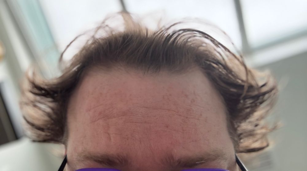 A cropped photo of my own hair which looks like I got electrocuted 