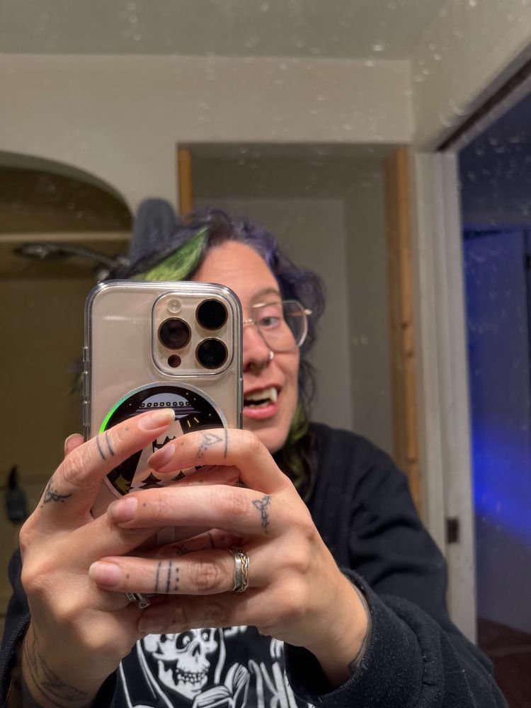 Me after an attempt at custom fangs that turned out to be WAY TOO BIG.