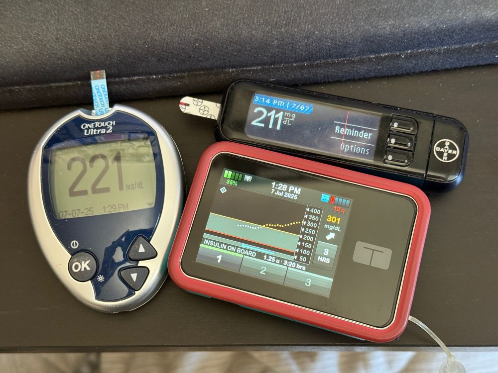 Two blood glucose meters and an insulin pump. The pump is reading 80-90 mg/dL higher than the blood sugar meters