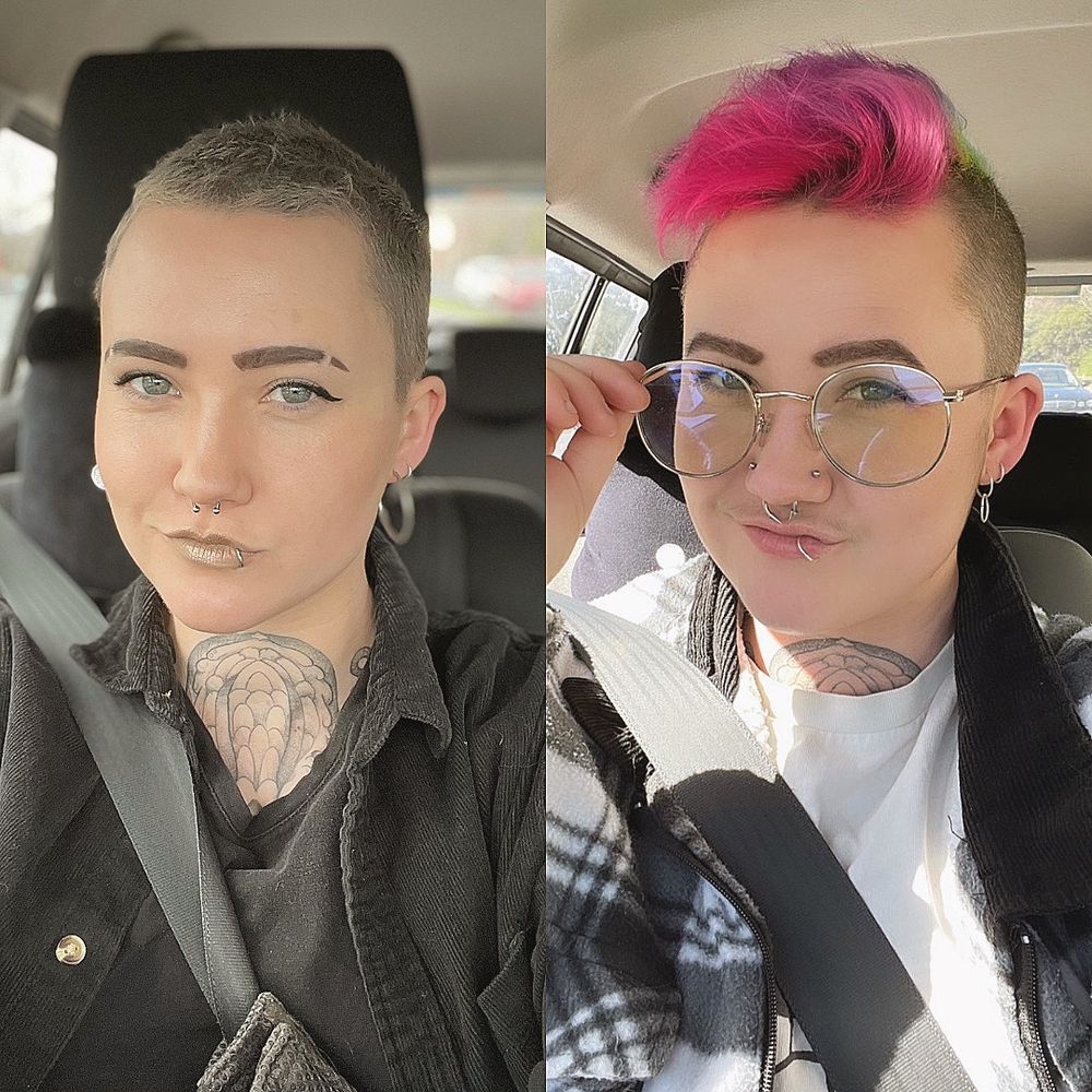 Right hand side A pic of me smiling into the camera while I’m sitting in the car after one year on Testosterone. I have a little bit of visible sideburns/ beginnings of a beard, and a baby moustache. As well as a more angular jaw and seemingly longer face