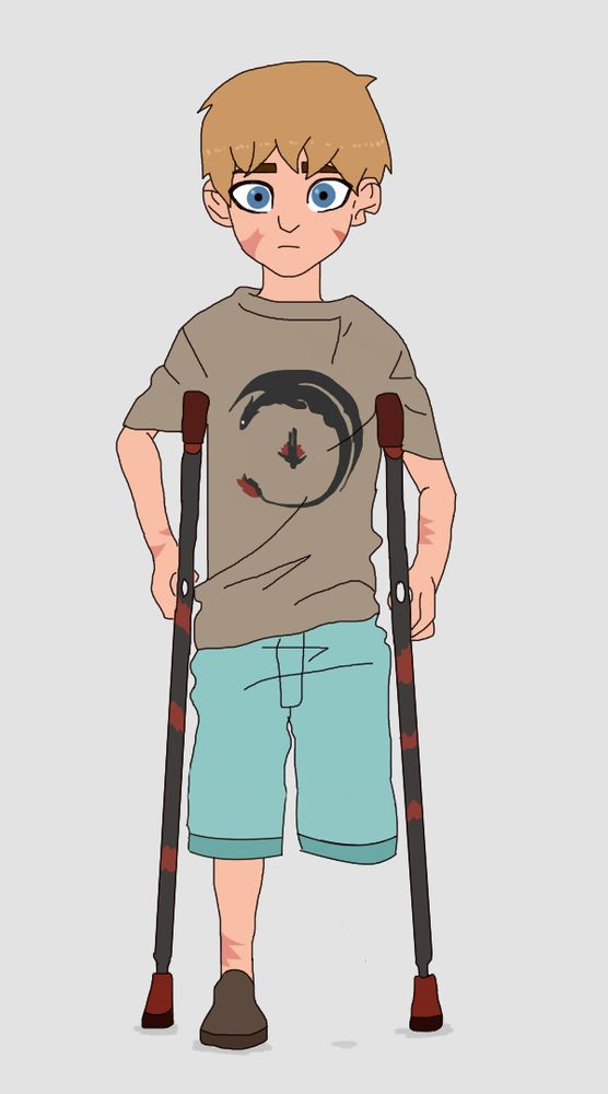 A boy covered in scars stands looking ahead with a blank expression, holding himself on one leg with crutches.  His left leg is missing from the knee down.