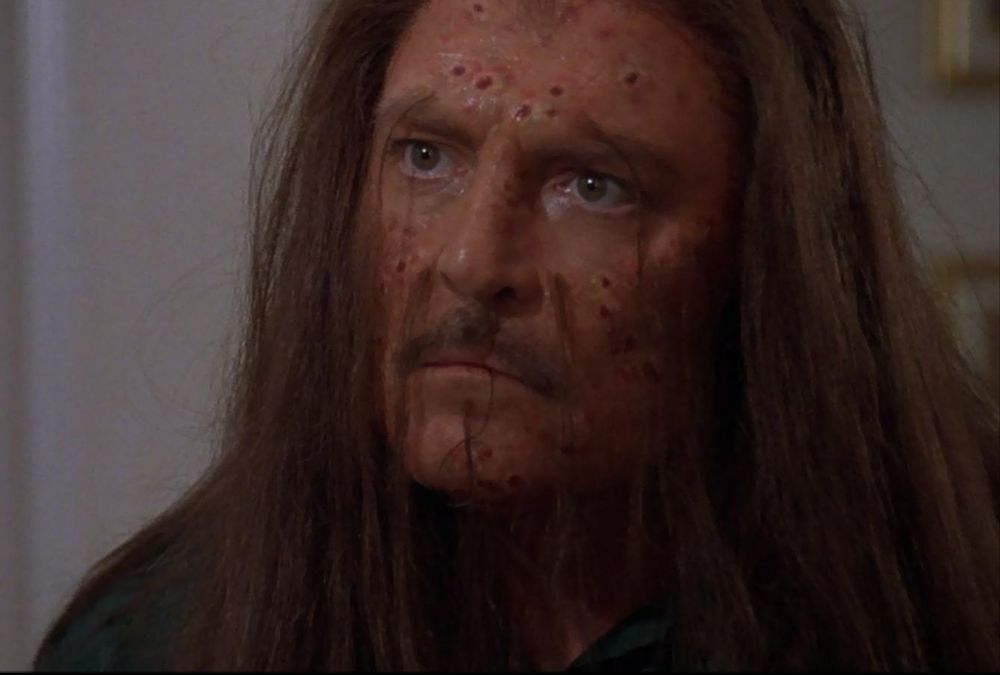 Stacy Keach looking despondent whilst dealing with a unique hair transplant situation in a segment from John Carpenter's Body Bags