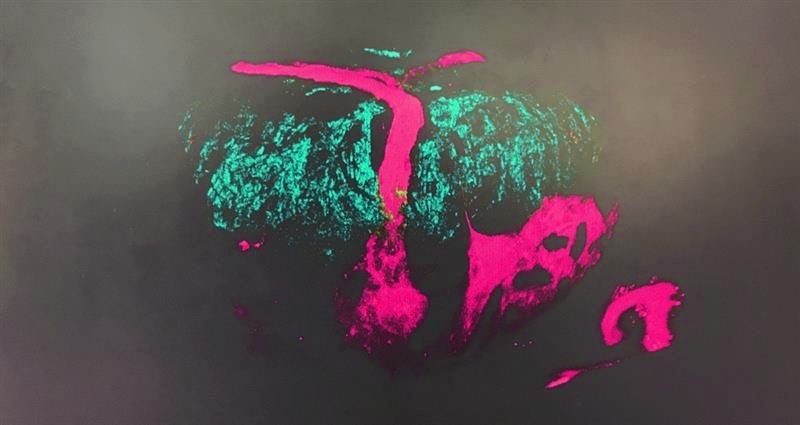 3D rendering of a Zebrafish embryo showing vasculature (GFP - magenta) and endogenous fluorescence (cyan) separated through Fluorescence Lifetime Imaging 