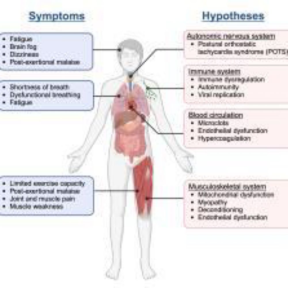 <b>Physical exertion worsens symptoms in patients with post-COVID condition</b> :  Post-exertional m...