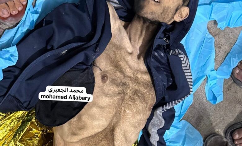 This is the 19th person to die of starvation in Gaza in the last 24 hours. May he Rest In Peace 