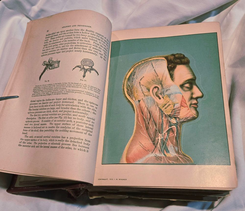 An antique medical illustration of a human head, partially dissected.