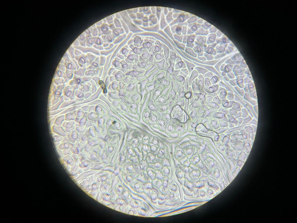 Ditto, of a different leaf with much smaller more concentrated stomata.