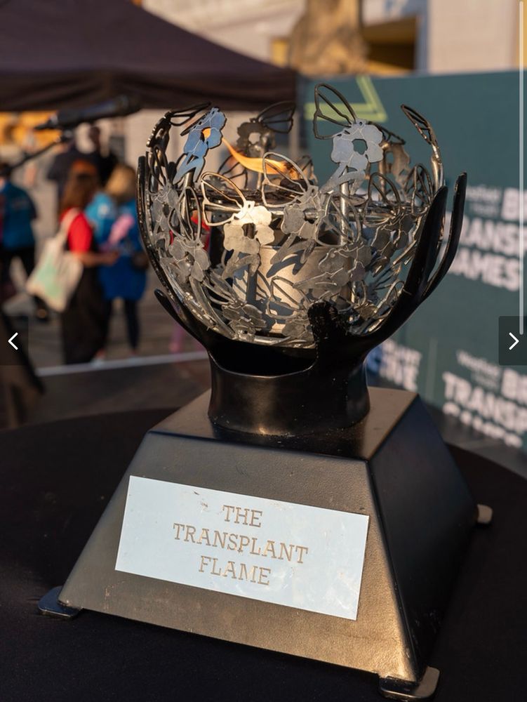 The Transplant Flame which was lit at the opening ceremony.