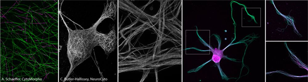 ANR-funded post-doctoral position in the NeuroCyto lab