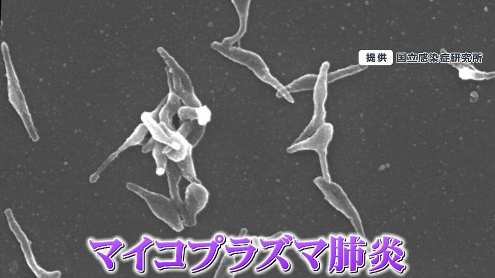 【大流行】マイコプラズマ肺炎東京で“最多”に…最大の特徴「乾いたせき」ってどんなせき？ 対策は？ - ライブドアニュース