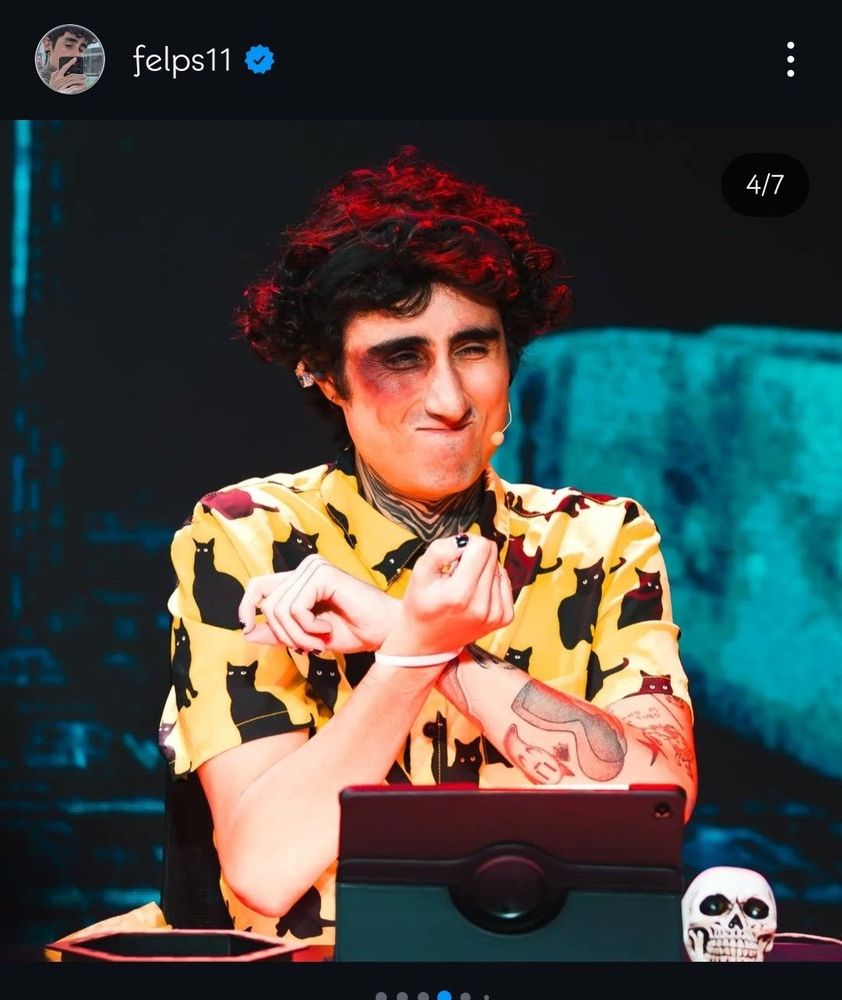 foto do felps com os punhos amarrados e uma maquiagem de olho roxo, ele está fazendo uma cara meio triste de dor