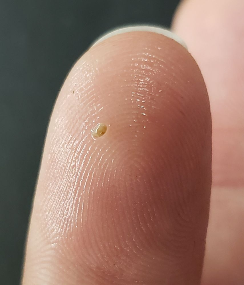 Heterocypris is a tiny tan colored ostracod on my fingertip