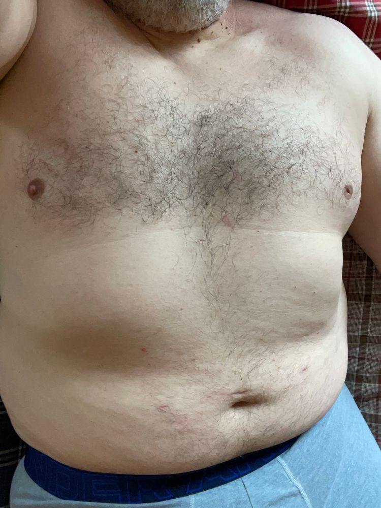My hairy chest and less hairy belly, with a peek of underwear.