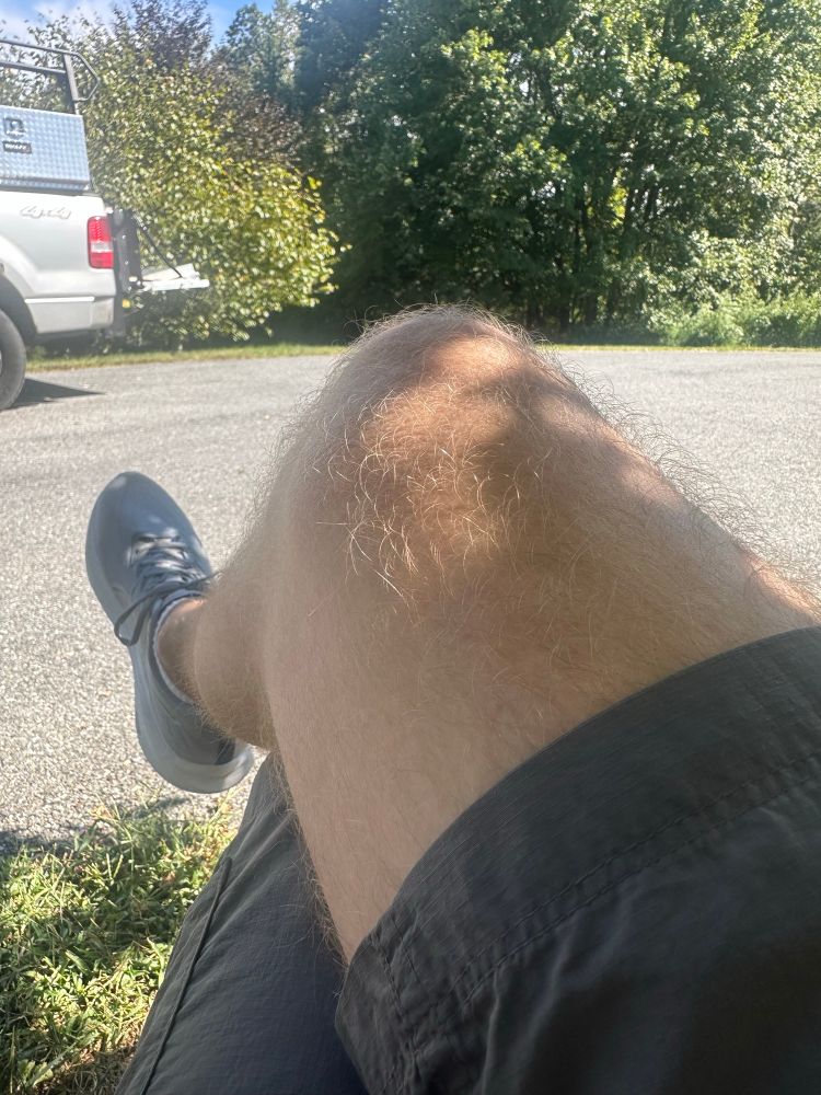 A leg 