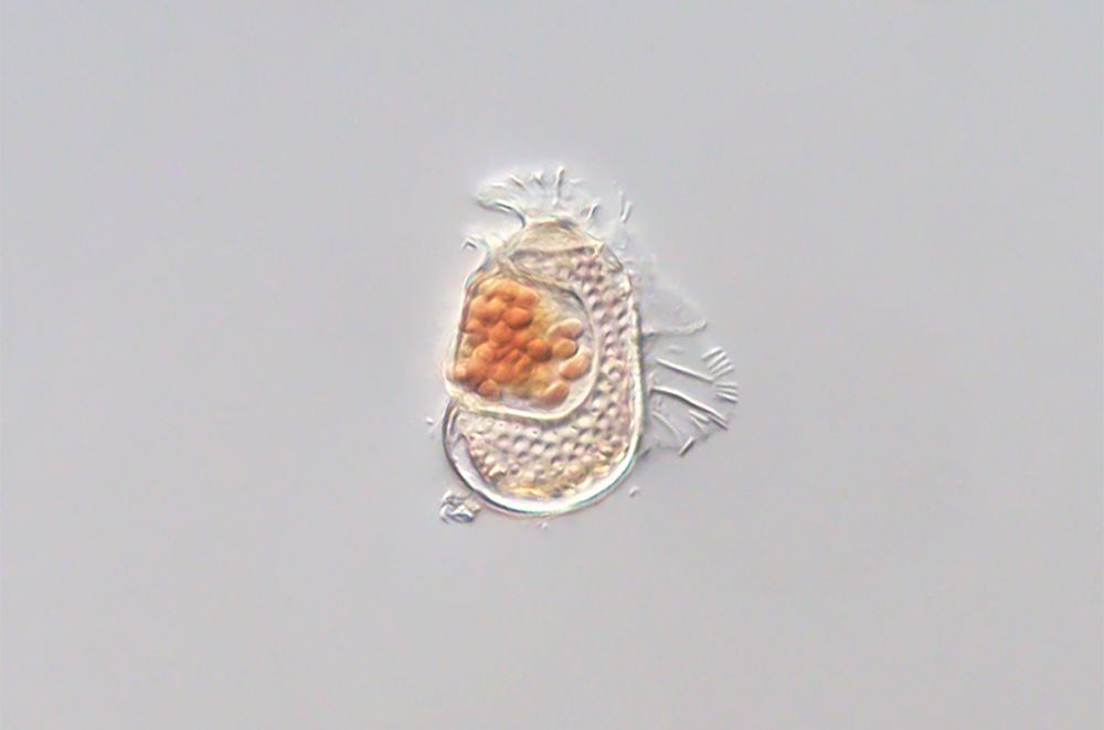 Image Source:
https://www.science.org/content/article/microbe-bizarrely-tiny-genome-may-be-evolving-virus

Hidden inside this dinoflagellate (Citharistes regius) is a tiny microbe so reliant on its host that scientists say it’s the most viruslike cellular organism known.

Credit
Takuro Nakayama/University of Tsukuba