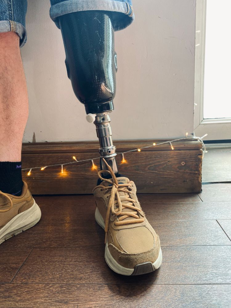 photo of the customer’s prosthetic leg after having the tattoo amputated