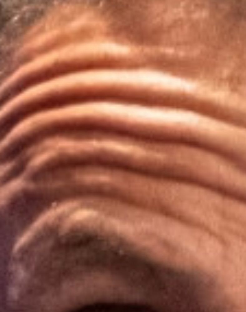 Zoom in on Cuomo's extremely creased forehead. 7 distinct ridges.