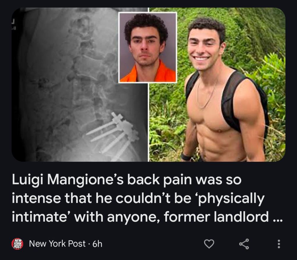 New York Post, yesterday: a photo of Luigi's nasty spine x ray full of pins next to his shitless hiking photo with his mugshot in between, and a headline reading Luigi Mangione's back pain was so intense that he couldn't be "physically intimate" with anyone, former landlord says