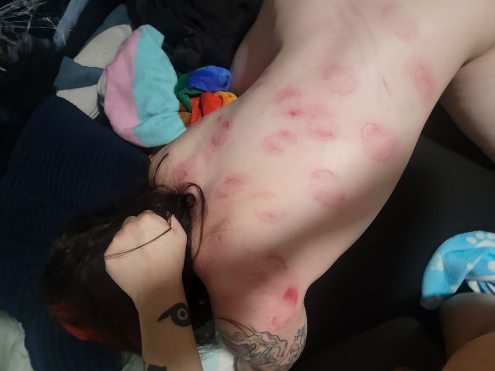 A woman face-down in a bed, with red bite marks all up and down her back. Her hair is being pulled by someone off-screen.