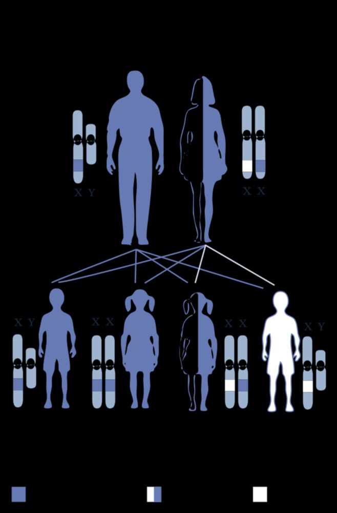 Morgagni–Stewart–Morel syndrome - Wikipedia