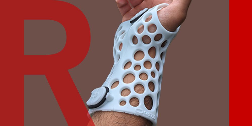 A wrist in a 3D printed cast, white plastic with many holes in.