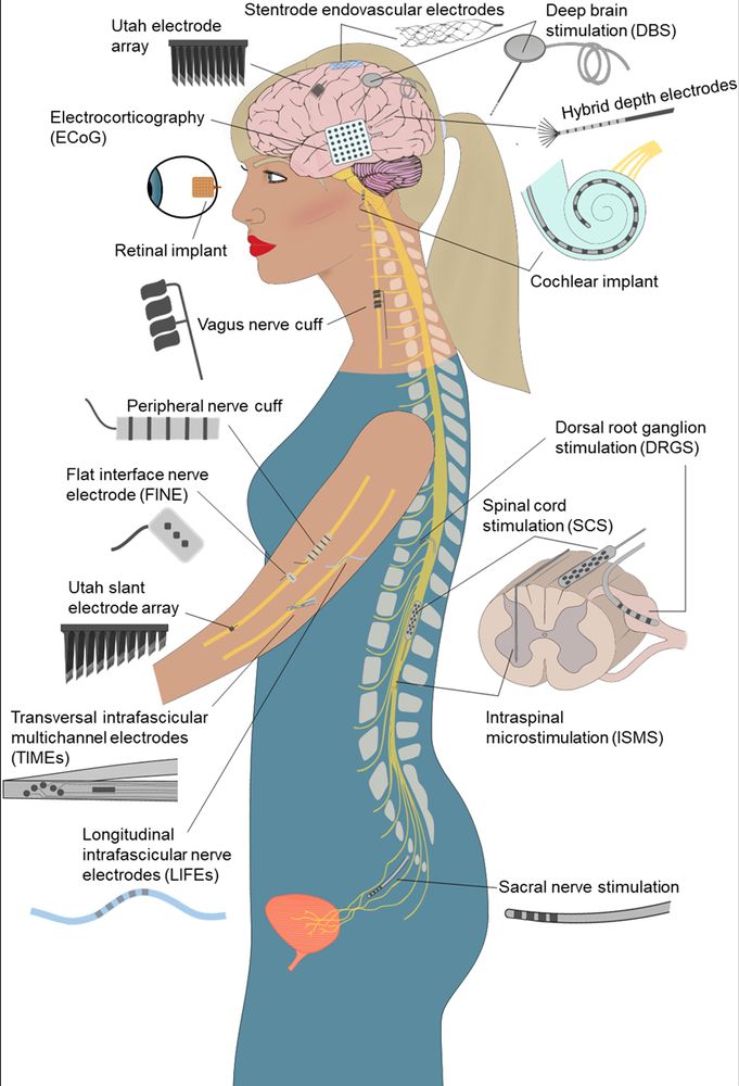 Implanted neural interfaces throughout the body