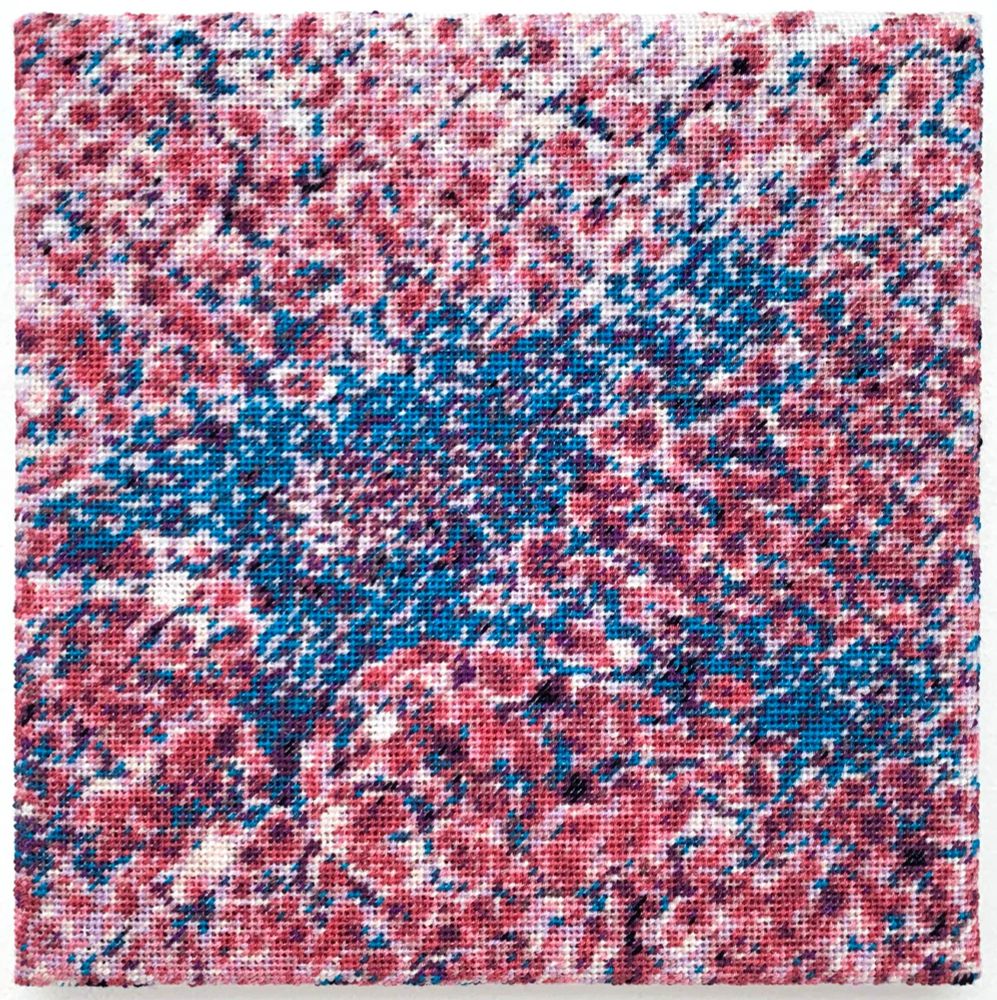 Embroidered representation of a Masson trichrome stain of a liver biopsy from a patient with primary biliary cholangitis. size : 20×20cm I used approximatively 15 colors. Variations of pink, red, beige, blue and white.