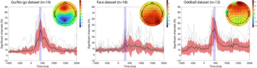 EEG is better left alone - Scientific Reports