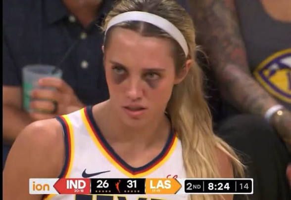 Lexie hull of the Indiana Fever is wearing a white jersey and a white headband. She’s got matching black eyes and looks off in the distance