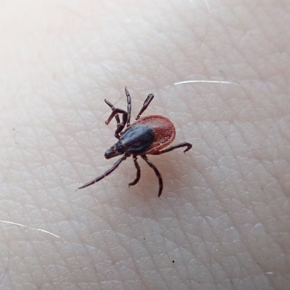 A tick walking on human skin.