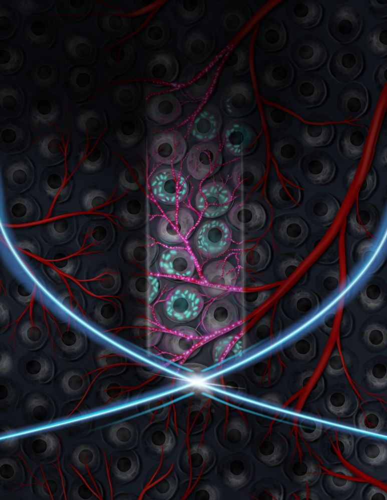 Cells and capillaries are being revealed by un ultrasound intersecting beam