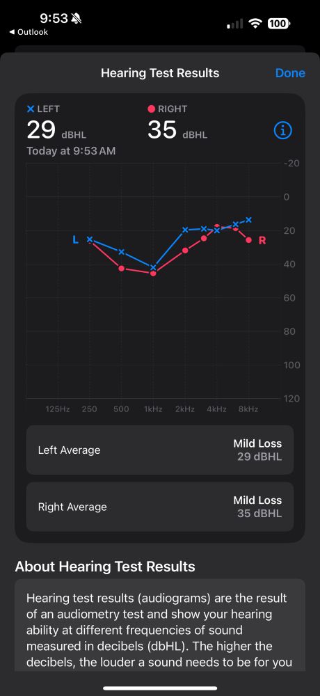 Hearing test results on iPhone with graph for left and right ear!

