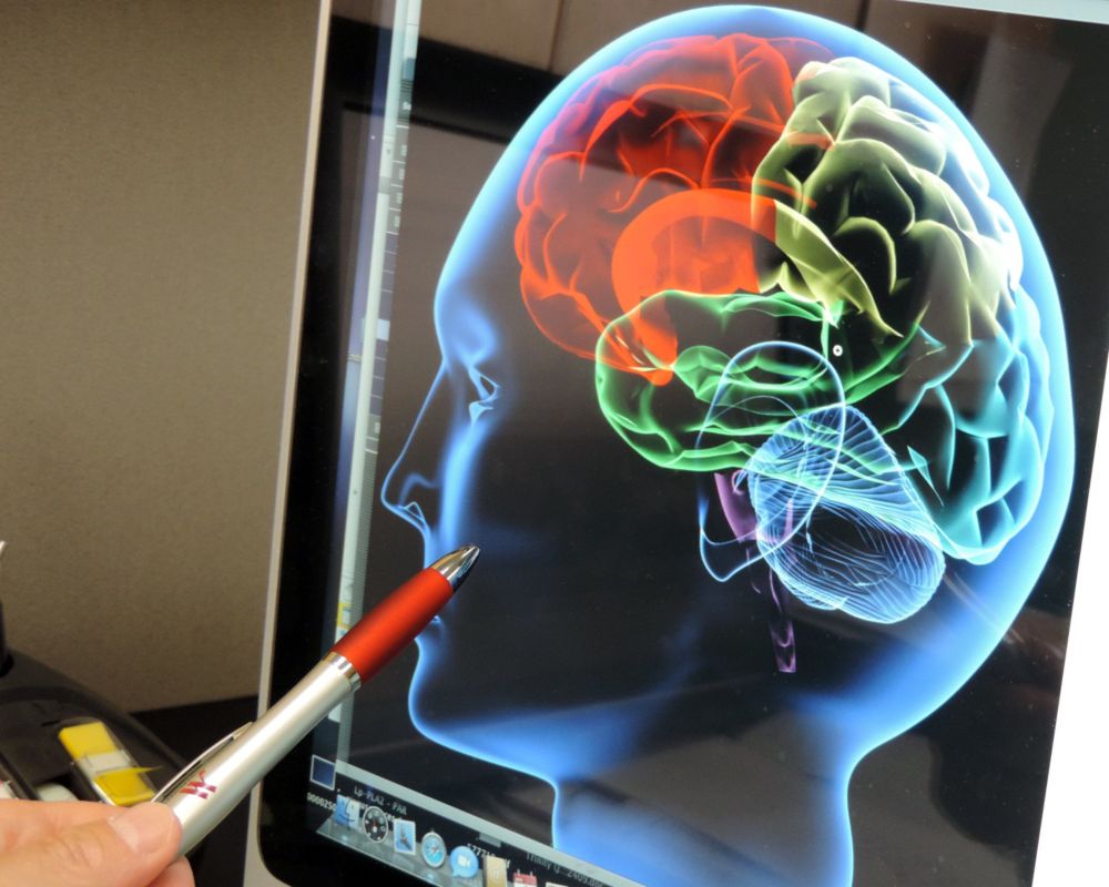 Clotbuster drug is new hope for stroke treatment