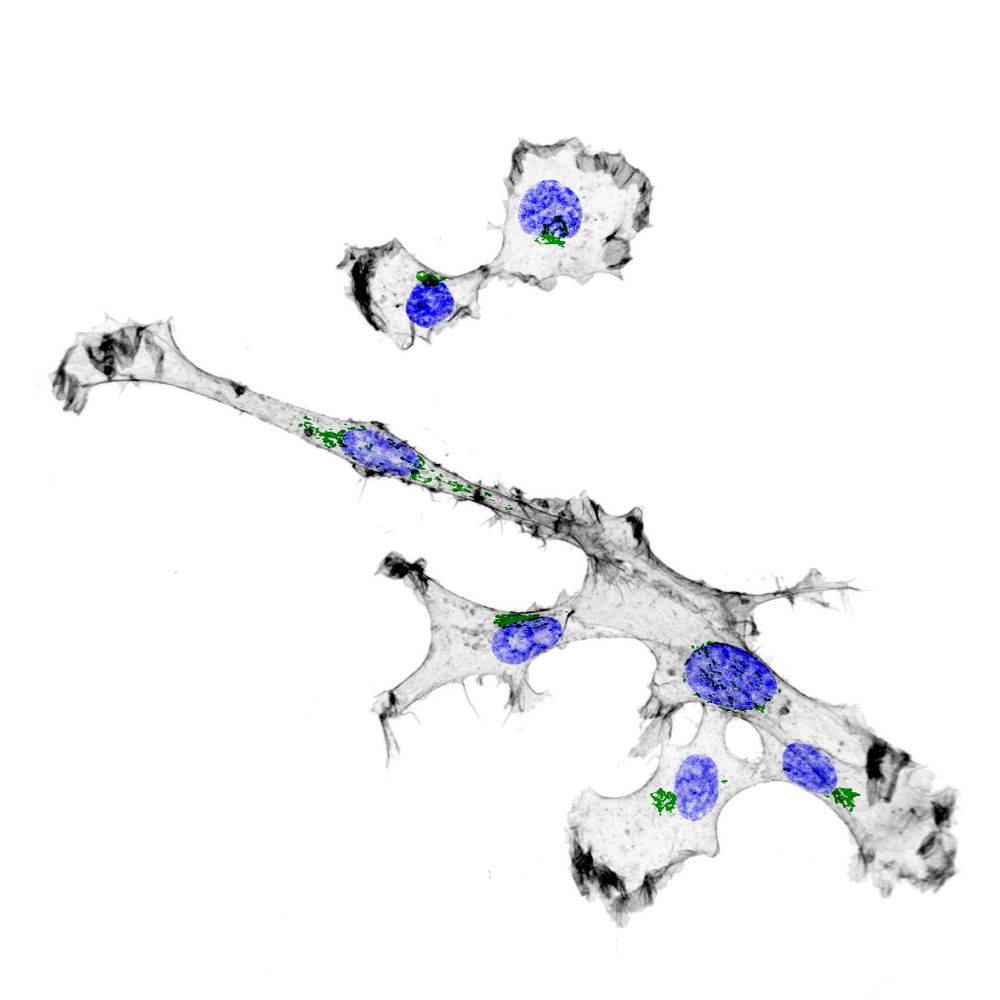 HT1080 cells with various morphologies. DAPI (blue) Phalloidin (grey) GM130 (green).