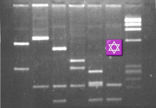 DNA gel electrophoresis but one of the bands is a star of David emoji