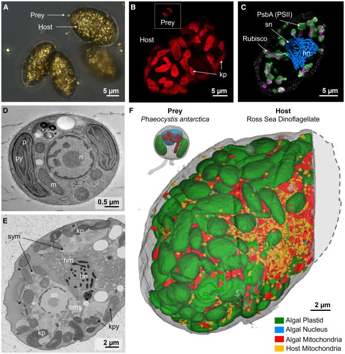 figure from the paper showing various views of the discussed microbial cell