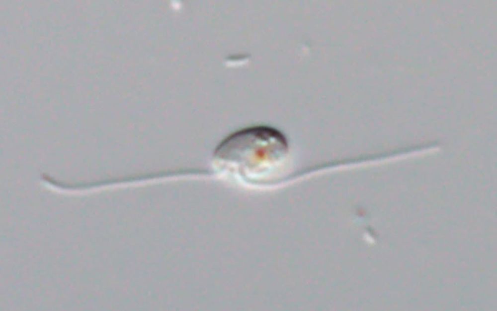 microscopic image of a single-celled organism with two long flagella