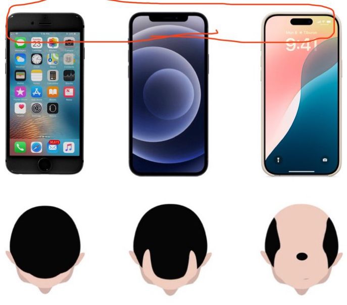 images of iphone having the notch altered, being similar to how male baldness is developed 
