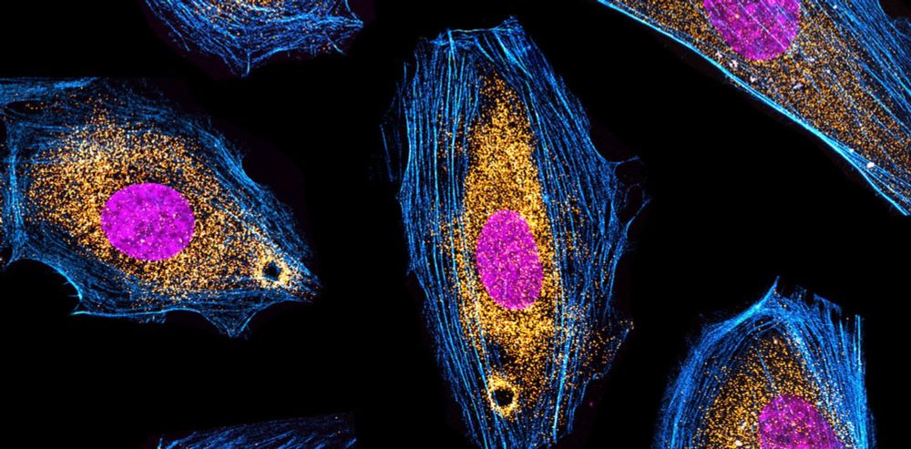 RNA-protein complexes: from molecular assembly to physiological functions and disease